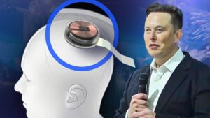 rajkotupdates.news : elon musk in 2022 neuralink start to implantation of brain chips in humans